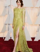 Emma-Stone-Upskirt-2015-Oscar-1
